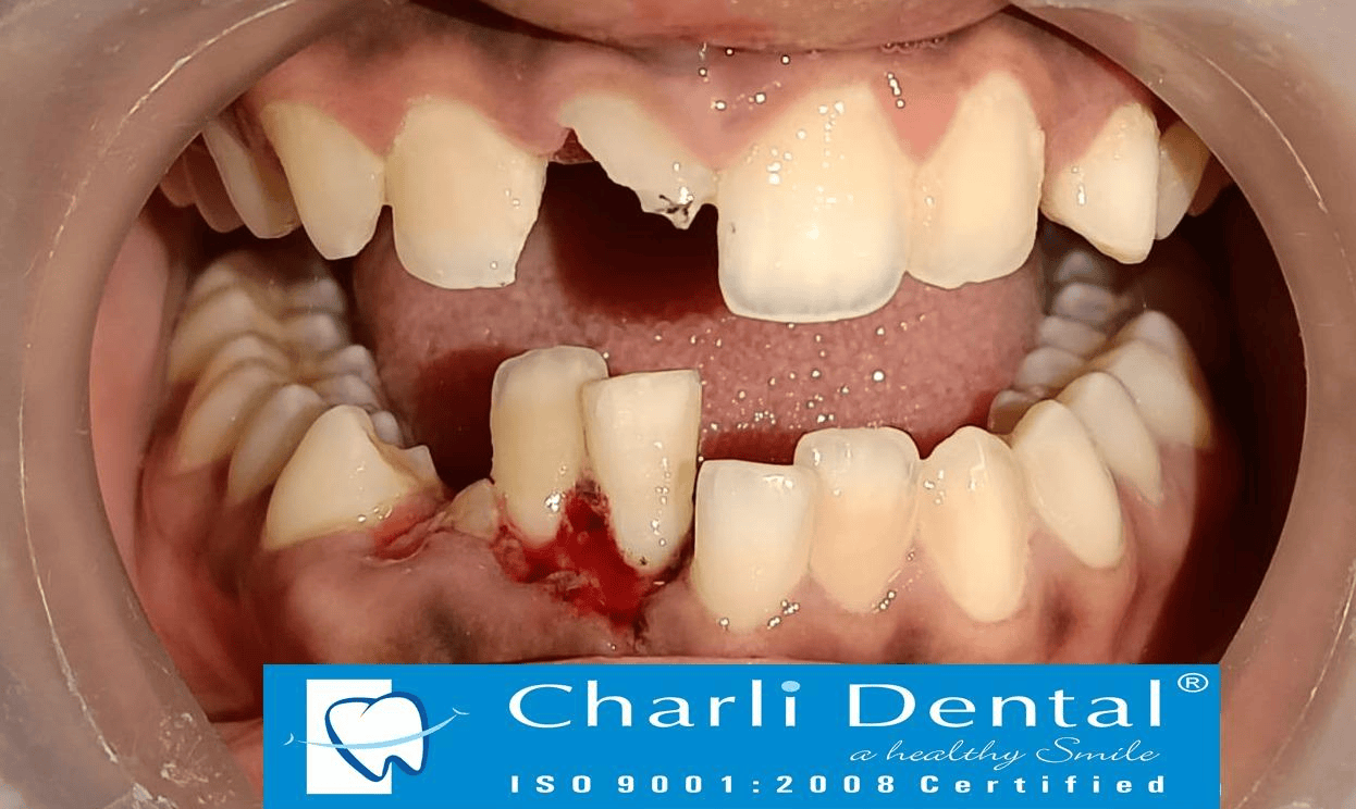 Trauma Case - Before